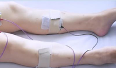 诊断、康复训练